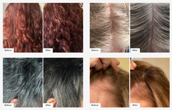 Before and After Real Result images of peoples hairs from using the ProLuxe Hair Care System.