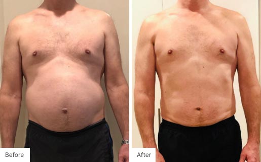2 - Before and After Real Results image of a man that has used the NeoraFit™ New Year Reset Program.